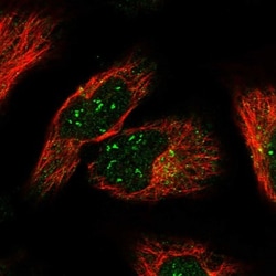 TMEM131L Antibody, Novus Biologicals 0.1mL; Unlabeled:Antibodies, Polyclonal